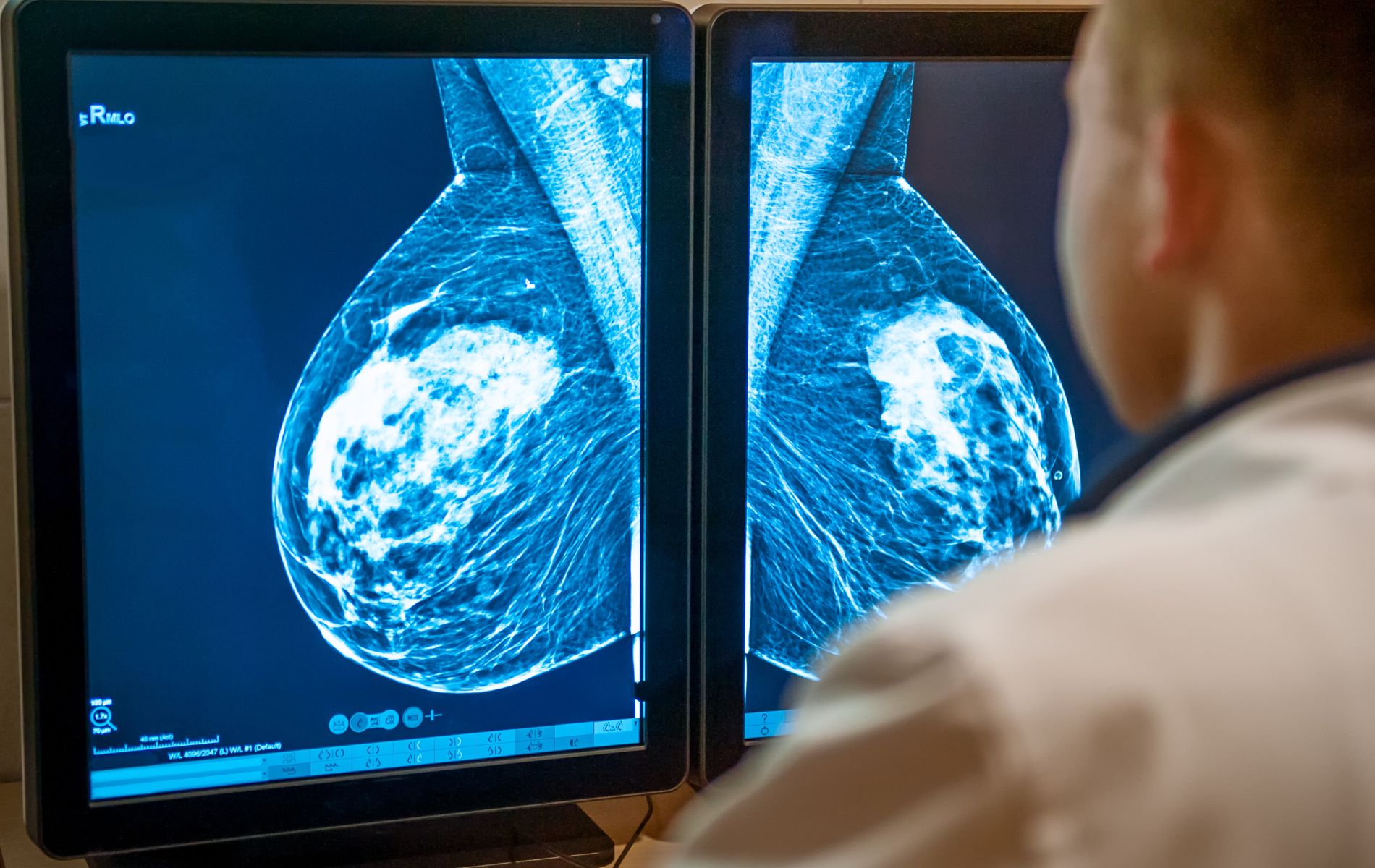 Using AI to Treat Breast Cancer, Clinical trials in-a-dish, NAM Journal, 3D bioprinting to Create Synthetic Blood Vessels and more 